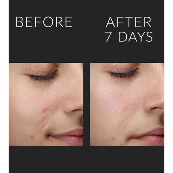 Kate Somerville Liquid ExfoliKate® Triple Acid Resurfacing Treatment 4OZ NIB - Picture 5 of 12